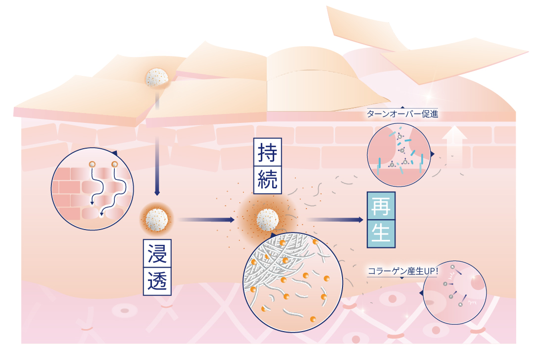 セクション図