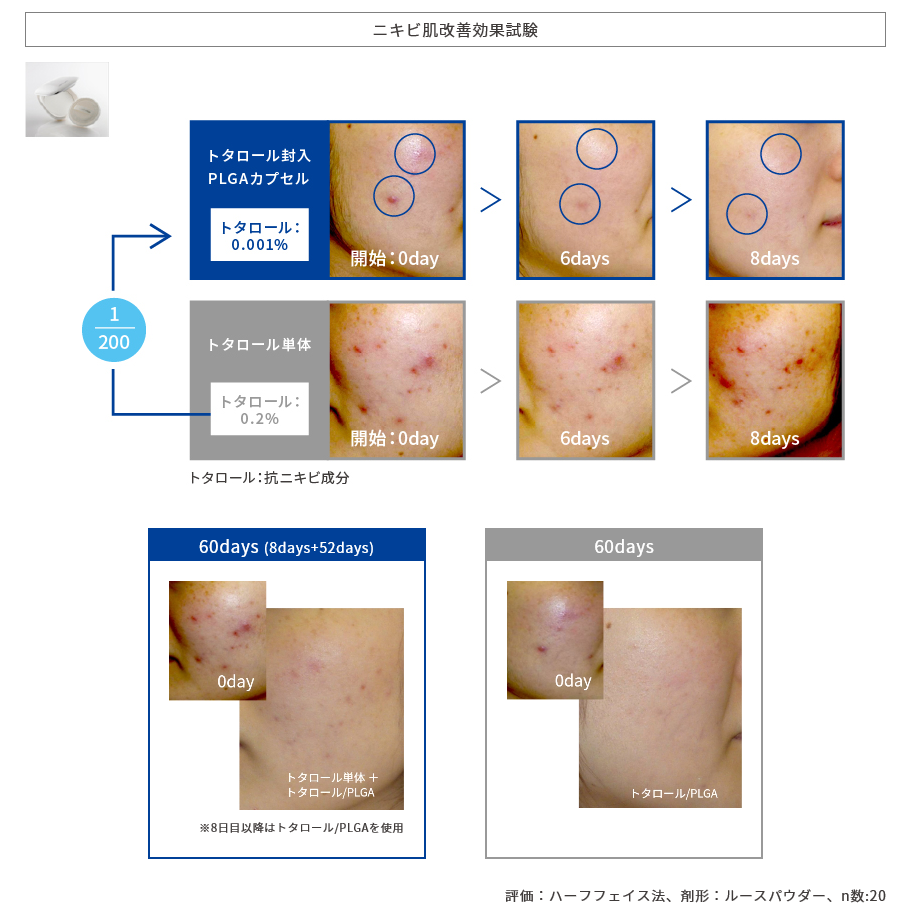 ニキビ肌改善効果試験
